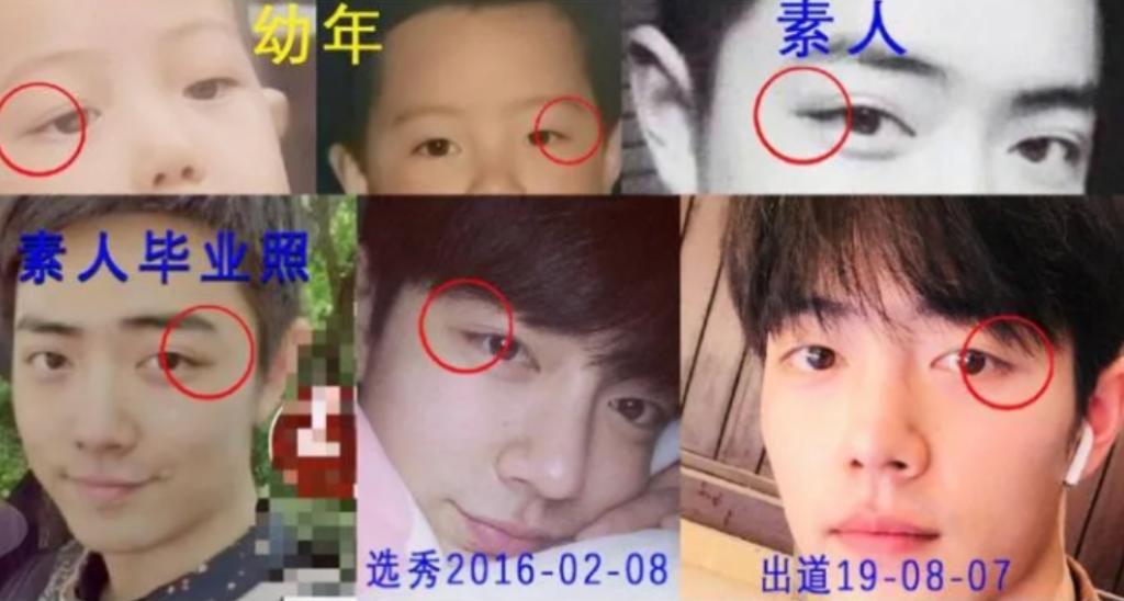 xiao zhan eyelid